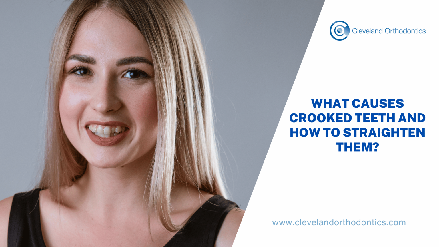 What Causes Crooked Teeth And How To Straighten Them Cleveland