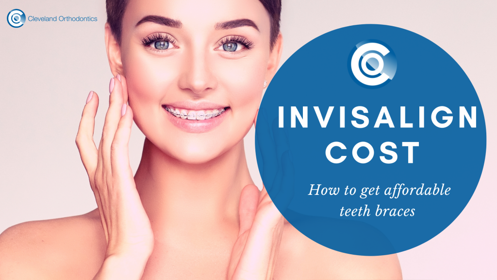 Invisalign Braces, Invisalign Costs