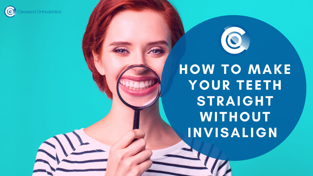 how to make your teeth straight without Invisalign