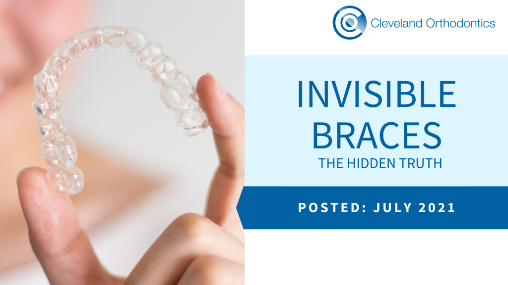 Invisible Braces - The Hidden Truth