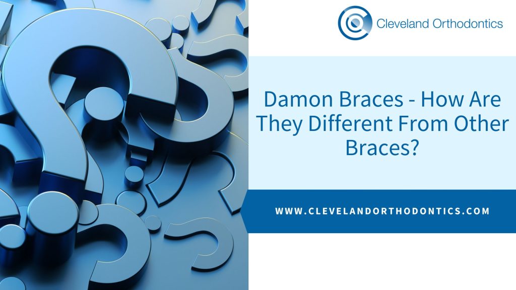Damon Braces - How Are They Different From Other Braces?