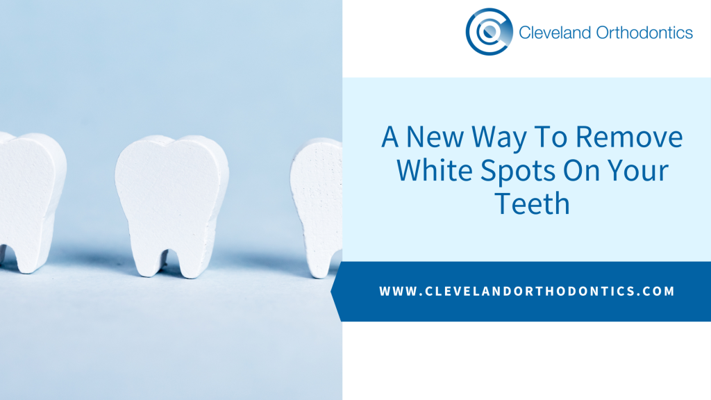 A New Way To Remove White Spots On Your Teeth