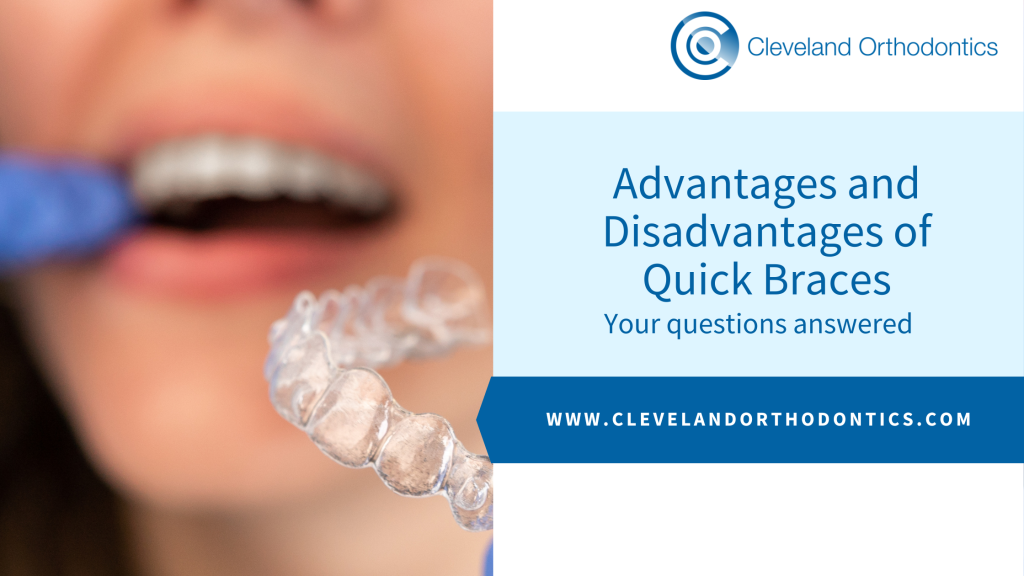 Advantages and Disadvantages of Quick Braces