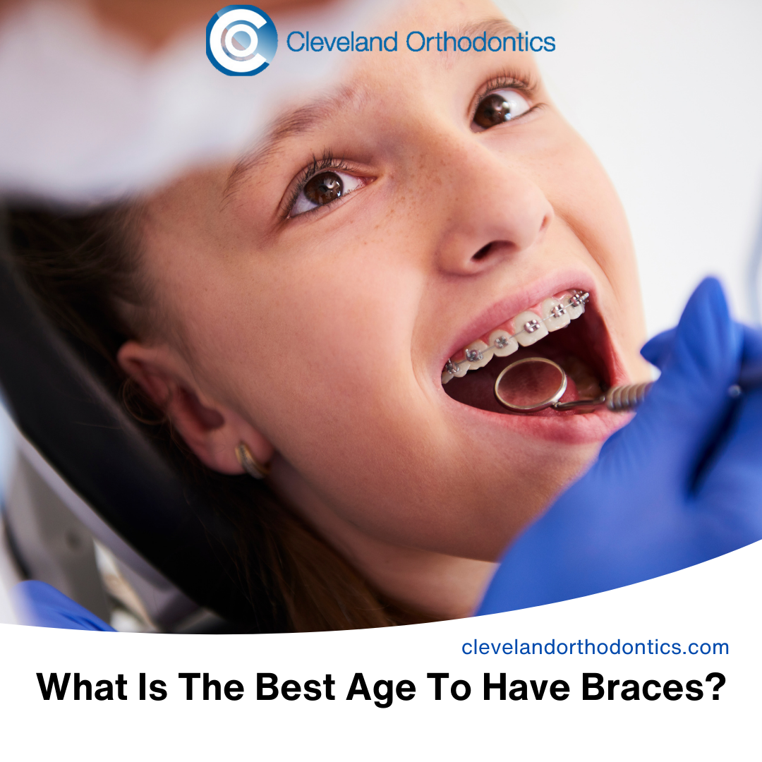 What Is The Best Age To Have Braces? Cleveland Orthodontics in