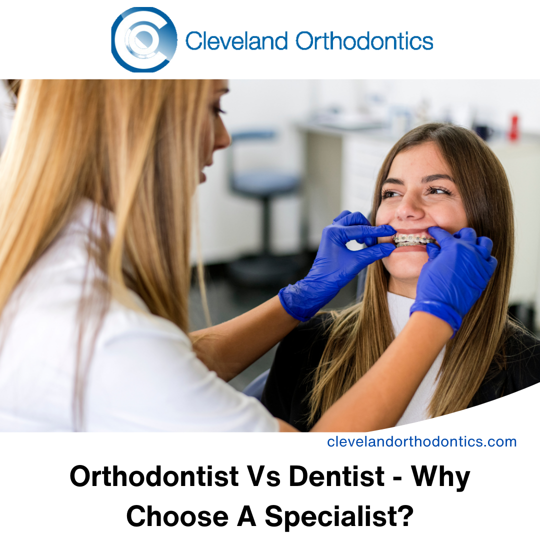 Orthodontist Vs Dentist Why Choose A Specialist? Cleveland