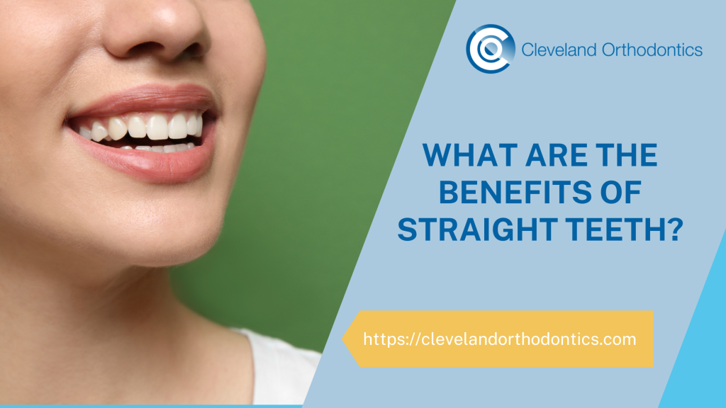 What Are The Benefits Of Straight Teeth?