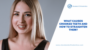 What Causes Crooked Teeth And How To Straighten Them?
