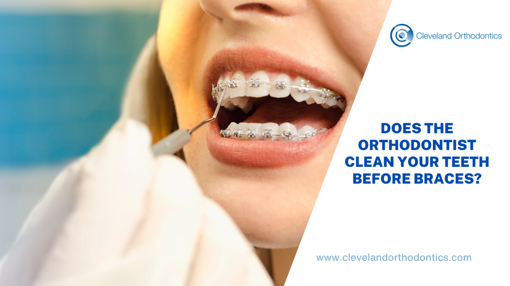 Does The Orthodontist Clean Your Teeth Before Braces?