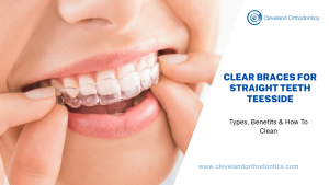 Clear Braces for Straight Teeth Teesside: