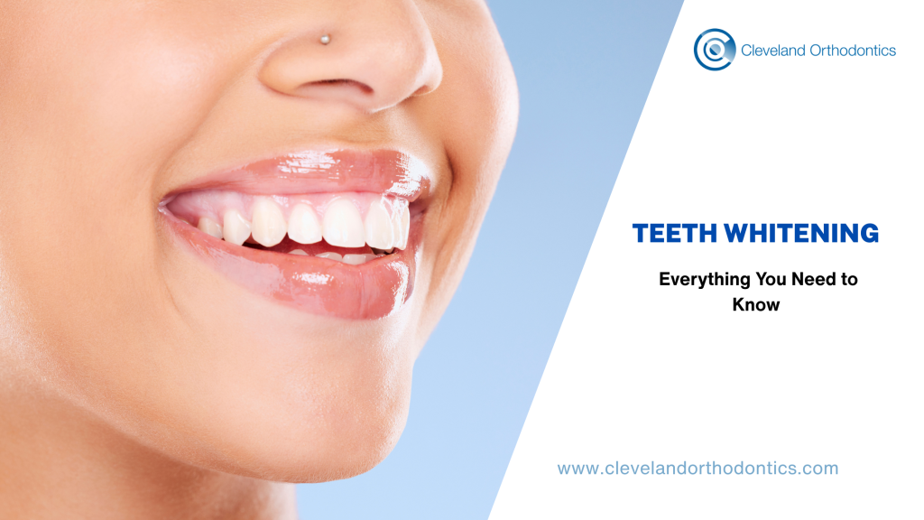 Teeth Whitening: Everything You Need To Know