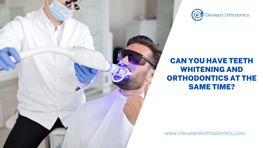 Considering braces and teeth whitening? Learn why dentists recommend waiting until after your orthodontic treatment for whitening, and how to keep your teeth white while wearing them.